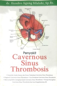Image of Penyakit Cavernous Sinus Thrombosis